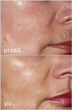 Software: Microsoft Office